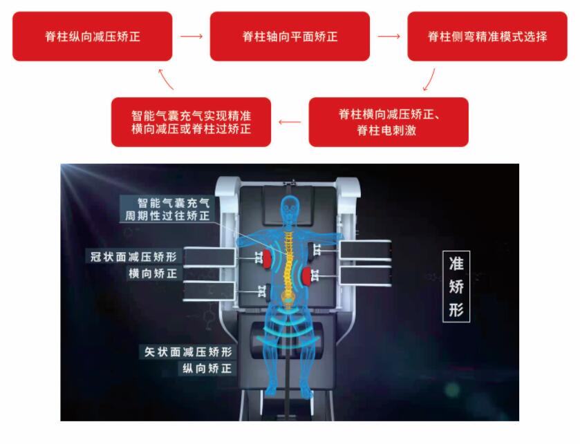 外星艙脊柱減壓矯形版